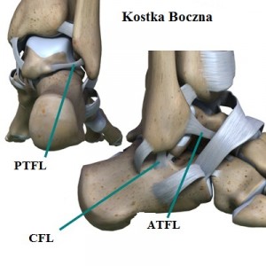 ankle_arthroscopy_ligaments