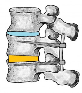 stabilizacja1